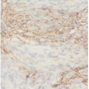 IHC-P analysis of mouse brain tissue, using EPHA6-Specific Antibody (1/50 dilution).