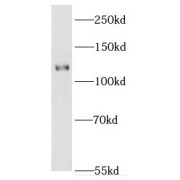 WB analysis of mouse brain tissue, using EPHA8 antibody (1/300 dilution).