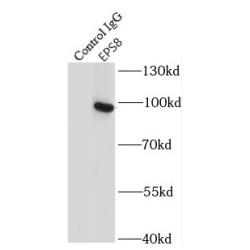 Epidermal Growth Factor Receptor Pathway Substrate 8 (EPS8) Antibody