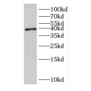 WB analysis of HeLa cells, using ERLIN2 antibody (1/500 dilution).