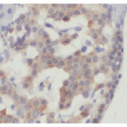 ERO1-Like (S. Cerevisiae) (ERO1L) Antibody