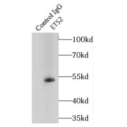 V-Ets Erythroblastosis Virus E26 Oncogene Homolog 2 (Avian) (ETS2) Antibody