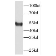 WB analysis of K-562 cells, using ETS2 antibody (1/1000 dilution).