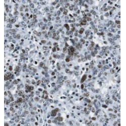 ETS Variant 4 (ETV4) Antibody