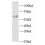 WB analysis of mouse heart tissue, using ETV4 antibody (1/500 dilution).