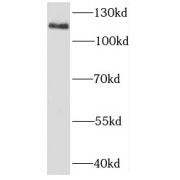 WB analysis of SKOV-3 cells, using EVI1 antibody (1/300 dilution).