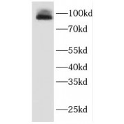 WB analysis of K-562 cells, using EWS antibody (1/2000 dilution).