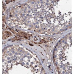 Exonuclease 3'-5' Domain Containing 1 (EXD1) Antibody