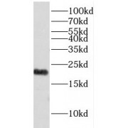 WB analysis of SGC-7901 cells, using EXOSC1 antibody (1/200 dilution).