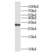 WB analysis of PC-3 cells, using EXOSC3 antibody (1/400 dilution).