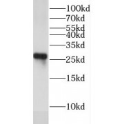WB analysis of Jurkat cells, using EXOSC4 antibody (1/500 dilution).