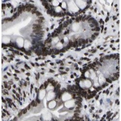 Exosome Component 7 (EXOSC7) Antibody