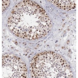 Exosome Component 8 (EXOSC8) Antibody