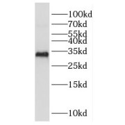 WB analysis of HeLa cells, using EXOSC8 antibody (1/500 dilution).