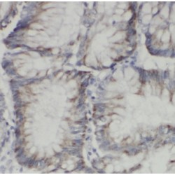 Exostoses (Multiple)-Like 3 (EXTL3) Antibody