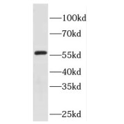 WB analysis of HeLa cells, using EYA2 antibody (1/100 dilution).