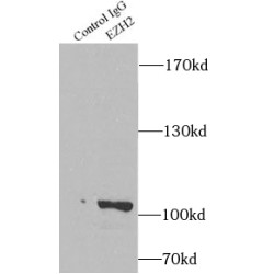 Histone-Lysine N-Methyltransferase EZH2 (EZH2) Antibody