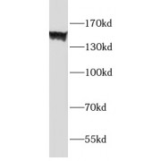 WB analysis of HL-60 cells, using F4/80 antibody (1/1000 dilution).
