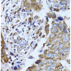 Fatty Acid-Binding Protein 4, Adipocyte (FABP4) Antibody