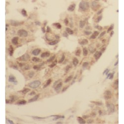 Fatty Acid-Binding Protein 4, Adipocyte (FABP4) Antibody