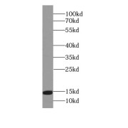 WB analysis of human brain tissue, using FABP7-Specific antibody (1/500 dilution).