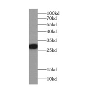 WB analysis of K-562 cells, using F12 antibody (1/1000 dilution).