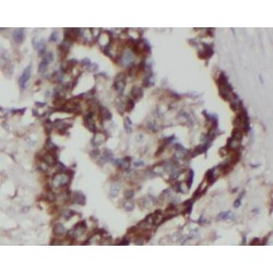 Fas (TNFRSF6)-Associated Via Death Domain (FADD) Antibody