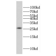 WB analysis of HepG2 cells, using FAM101A antibody (1/500 dilution).