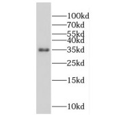 WB analysis of COLO 320 cells, using FAM105A antibody (1/300 dilution).