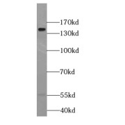WB analysis of HepG2 cells, using FAM62A antibody (1/500 dilution).