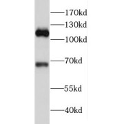 WB analysis of human skeletal muscle tissue, using FAM65B antibody (1/500 dilution).