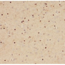 Family With Sequence Similarity 71 Member E2 (FAM71E2) Antibody