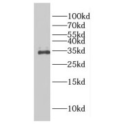 WB analysis of mouse liver tissue, using FAM78A antibody (1/500 dilution).