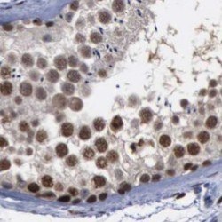 Fanconi Anemia Complementation Group D2 (FANCD2) Antibody