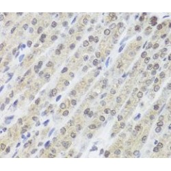 E3 Ubiquitin-Protein Ligase FANCL (FANCL) Antibody