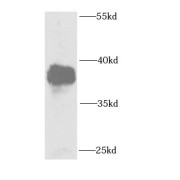 WB analysis of human brain tissue, using E3 Ubiquitin-Protein Ligase FANCL antibody (1/1000 dilution).