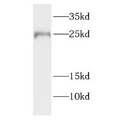 WB analysis of human testis tissue, using FATE1 antibody (1/800 dilution).