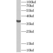 WB analysis of mouse liver tissue, using FBP1 antibody (1/5000 dilution).
