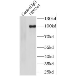 F-Box Protein 41 (FBXO41) Antibody