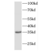 WB analysis of mouse liver tissue, using FBXO6 antibody (1/300 dilution).
