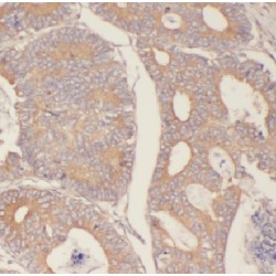 F-Box And WD Repeat Domain Containing 2 (FBXW2) Antibody