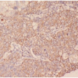Fc Receptor-Like B (FCRLB) Antibody