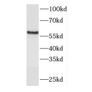 WB analysis of Transfected HEK-293 cells, using FCRLB antibody (1/1000 dilution).