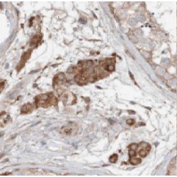 Ferredoxin-Fold Anticodon Binding Domain Containing 1 (FDXACB1) Antibody
