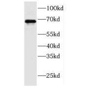 WB analysis of human placenta tissue, using FDXACB1 antibody (1/1000 dilution).