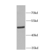 WB analysis of mouse brain tissue, using FECH antibody (1/1000 dilution).