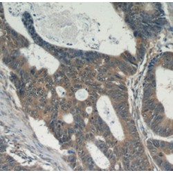 Tyrosine Protein Kinase Fer (FER) Antibody