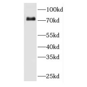 WB analysis of mouse kidney tissue, using FERMT1 antibody (1/300 dilution).