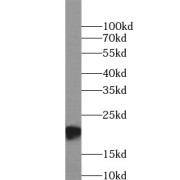 WB analysis of human placenta tissue, using FTL antibody (1/1000 dilution).