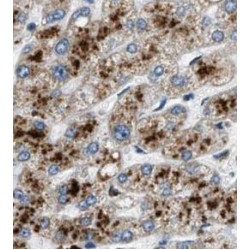 Fetuin-A (FETUA) Antibody
